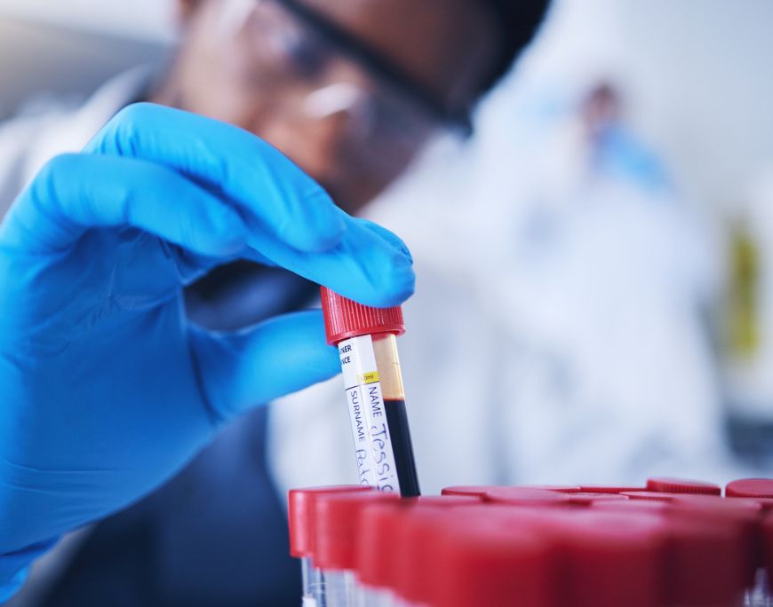How AI and Automation Are Transforming Medical Laboratories in 2025