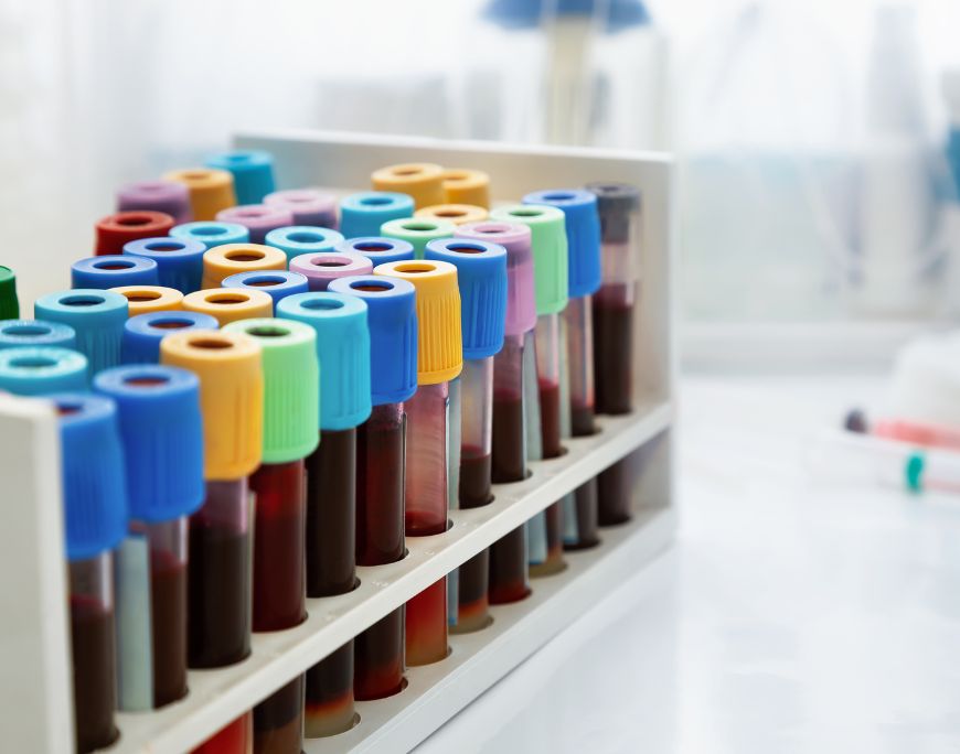 Post-Analytical Solutions: Closing the Loop with Efficiency